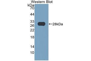 Western blot analysis of the recombinant protein. (Thyroperoxidase Antikörper  (AA 636-832))
