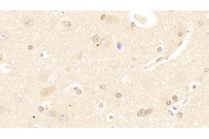 Detection of SAT1 in Human Cerebrum Tissue using Polyclonal Antibody to Spermidine/Spermine N1-Acetyltransferase 1 (SAT1) (SAT1 Antikörper  (AA 1-171))