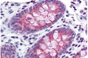 Colon, Human: Formalin-Fixed, Paraffin-Embedded (FFPE) (TMPRSS4 Antikörper  (Internal Region))