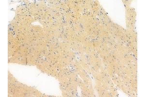 ABIN6258312 and ABIN6273385 at 1/100 staining human normal colon tissue by IHC-P. (RFPL1 Antikörper  (Internal Region))