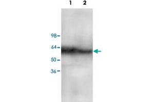 Western blot analysis of Jurkat (Lane 1) and MCF-7 (Lane 2) cell lysate with CARD10 polyclonal antibody  at 1 : 200 dilution. (CARD10 Antikörper  (C-Term))