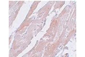 Immunohistochemistry of CCDC47 in mouse heart tissue with CCDC47 antibody at 5 μg/ml. (CCDC47 Antikörper  (C-Term))