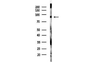 anti-Discs, Large Homolog 2 (DLG2) (N-Term) antibody