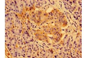 Immunohistochemistry of paraffin-embedded human pancreatic tissue using ABIN7166602 at dilution of 1:100 (PSORS1C1 Antikörper  (AA 1-152))