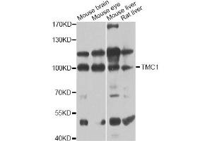 Western blot analysis of extracts of various cell lines, using TMC1 antibody (ABIN6293566) at 1:1000 dilution. (TMC1 Antikörper)
