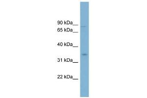 GPD2 antibody used at 1 ug/ml to detect target protein. (GPD2 Antikörper)