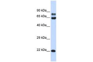 WB Suggested Anti-PPP2R1A Antibody Titration: 0. (PPP2R1A Antikörper  (N-Term))