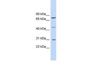 WB Suggested Anti-EGR3 Antibody Titration:  0. (EGR3 Antikörper  (Middle Region))