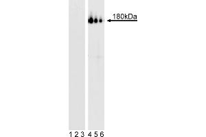 Western Blotting (WB) image for anti-Platelet Derived Growth Factor Receptor beta (PDGFRB) (pTyr857) antibody (ABIN967592)