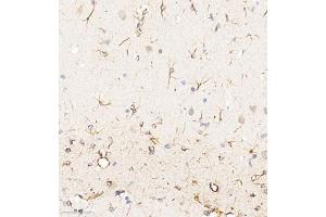 Immunohistochemistry of paraffin embedded rat brain using ACyclaseI (ABIN7072958) at dilution of 1:650 (300x lens) (ADCY1 Antikörper)