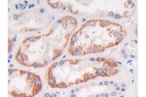 Detection of FGFRL1 in Human Kidney Tissue using Polyclonal Antibody to Fibroblast Growth Factor Receptor Like Protein 1 (FGFRL1) (FGFRL1 Antikörper  (AA 168-378))