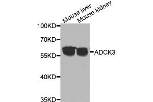 Western blot analysis of extracts of various cell lines, using ADCK3 antibody (ABIN5975514) at 1/1000 dilution. (COQ8A Antikörper)