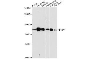 Western blot analysis of extracts of various cell lines, using F13A1 antibody. (F13A1 Antikörper  (AA 600-732))