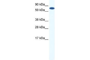 WB Suggested Anti-CBFA2T2H Antibody Titration:  0.