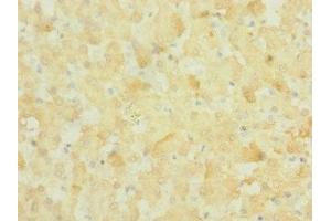 Immunohistochemistry of paraffin-embedded human liver tissue using ABIN7161008 at dilution of 1:100