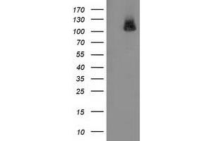 Western Blotting (WB) image for anti-phosphodiesterase 2A, CGMP-Stimulated (PDE2A) antibody (ABIN1500080)