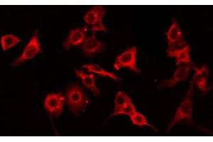 ABIN6275062 staining HT29 by IF/ICC. (GNPAT Antikörper  (Internal Region))