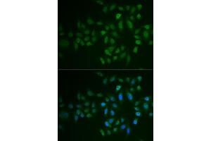 Immunofluorescence analysis of U2OS cells using MYLK3 antibody (ABIN6129615, ABIN6144266, ABIN6144267 and ABIN6222364).