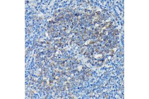 Immunohistochemistry of paraffin-embedded Mouse spleen using Alpha-tubulin (ubiquitous) chain antibody (ABIN7271033) at dilution of 1:50 (40x lens). (TUBA1B Antikörper  (AA 1-451))