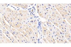 Immunohistochemistry (IHC) image for anti-Activin Receptor Type I (ACRV1) (AA 208-340) antibody (ABIN7437131)
