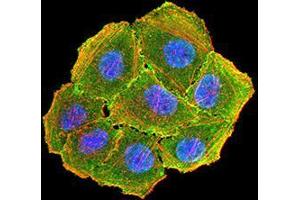 Immunocytochemistry (ICC) image for anti-Cyclin D1 (CCND1) (AA 167-295) antibody (ABIN5862106) (Cyclin D1 Antikörper  (AA 167-295))