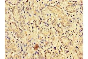 Immunohistochemistry (IHC) image for anti-Ephrin Type A Receptor 1 (EPHA1) (AA 296-414) antibody (ABIN7151827)