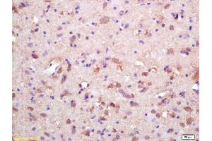 Formalin-fixed and paraffin embedded rat brain labeled with Rabbit Anti HSP10/CPN10 Polyclonal Antibody, Unconjugated (ABIN721885) at 1:200 followed by conjugation to the secondary antibody and DAB staining (HSPE1 Antikörper  (AA 51-102))