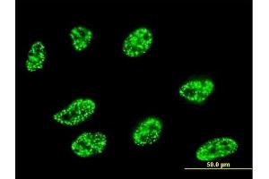 Immunofluorescence of monoclonal antibody to DLL1 on HeLa cell. (DLL1 Antikörper  (AA 18-109))