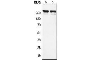 Western blot analysis of NCOR1 expression in K562 (A), HeLa (B) whole cell lysates. (NCOR1 Antikörper  (N-Term))