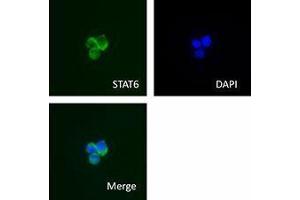 Immunofluorescence (IF) image for anti-Signal Transducer and Activator of Transcription 6, Interleukin-4 Induced (STAT6) antibody (ABIN2666296) (STAT6 Antikörper)