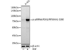 Western blot analysis of extracts of A-431 cells, using Phospho-p90Rsk/RSK1/RPS6K-S380 antibody (ABIN7270036) at 1:1000 dilution. (RPS6KA1 Antikörper  (pSer380))