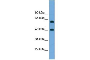 WB Suggested Anti-TERF2IP Antibody Titration: 0. (RAP1 Antikörper  (Middle Region))