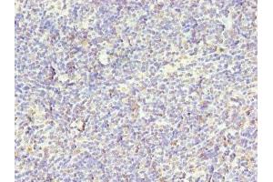 Immunohistochemistry of paraffin-embedded human thymus tissue using ABIN7169003 at dilution of 1:100 (STK38L Antikörper  (AA 212-464))
