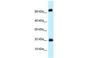 Image no. 1 for anti-Zinc Finger Protein 580 (ZNF580) (AA 58-107) antibody (ABIN6748023) (ZNF580 Antikörper  (AA 58-107))