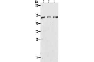 Western Blotting (WB) image for anti-Poly (ADP-Ribose) Polymerase 1 (PARP1) antibody (ABIN2432195) (PARP1 Antikörper)