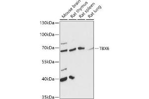 Western blot analysis of extracts of various cell lines, using TBX6 antibody (ABIN7270702) at 1:1000 dilution. (T-Box 6 Antikörper  (AA 191-300))