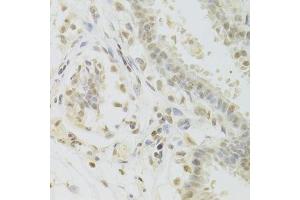 Immunohistochemistry (Paraffin-embedded Sections) (IHC (p)) image for anti-PRP3 Pre-mRNA Processing Factor 3 Homolog (PRPF3) (AA 1-280) antibody (ABIN6146260)