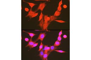 Immunofluorescence analysis of NIH-3T3 cells using Phospho-PDK1/PDPK1-S241 Rabbit pAb (ABIN6135282, ABIN6136186, ABIN6136187 and ABIN6225525) at dilution of 1:100 (40x lens). (PDPK1 Antikörper  (pSer241))