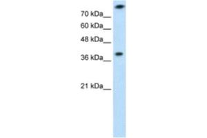 Western Blotting (WB) image for anti-Thiosulfate Sulfurtransferase (Rhodanese) (TST) antibody (ABIN2462532)