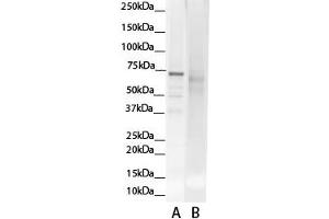 WB Suggested Anti-GCLC Antibody Titration: 0.