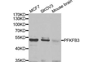 Western blot analysis of extracts of various cell lines, using PFKFB3 antibody (ABIN5974173) at 1/1000 dilution. (PFKFB3 Antikörper)
