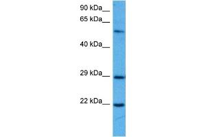 Western Blotting (WB) image for anti-Suppressor of Cytokine Signaling 1 (SOCS1) (N-Term) antibody (ABIN2777164)