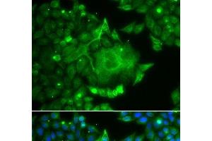 Immunofluorescence analysis of A549 cells using CACNG4 Polyclonal Antibody (CACNG4 Antikörper)