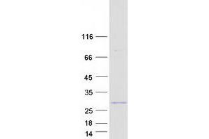 Western Blotting (WB) image for Chromosome 16 Open Reading Frame 80 (C16orf80) protein (Myc-DYKDDDDK Tag) (ABIN2722327)