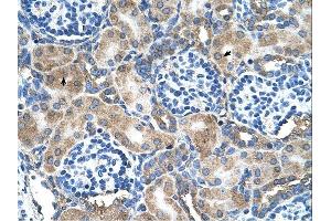 SOD1 antibody was used for immunohistochemistry at a concentration of 4-8 ug/ml. (SOD1 Antikörper  (N-Term))