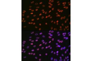 Immunofluorescence analysis of C6 cells using SMC1 Rabbit mAb (ABIN7270614) at dilution of 1:100 (40x lens). (SMC1A Antikörper)