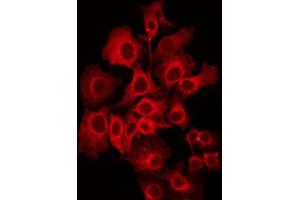 ABIN6272392 staining NIH-3T3 by IF/ICC. (PIPOX Antikörper  (Internal Region))