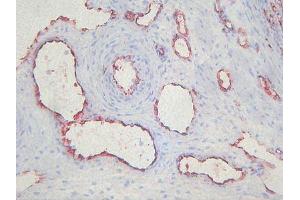 Immunohistochemistry (IHC) image for anti-Endothelial Cells antibody (ABIN781798) (Endothelial Cells Antikörper)