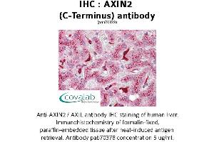 Image no. 1 for anti-Axin 2 (AXIN2) antibody (ABIN1732157) (AXIN2 Antikörper)