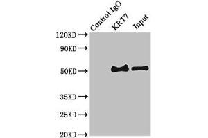 Immunoprecipitating KRT7 in HepG2 whole cell lysate Lane 1: Rabbit control IgG (1 μg) instead of ABIN7157444 in HepG2 whole cell lysate. (Cytokeratin 7 Antikörper  (AA 2-469))